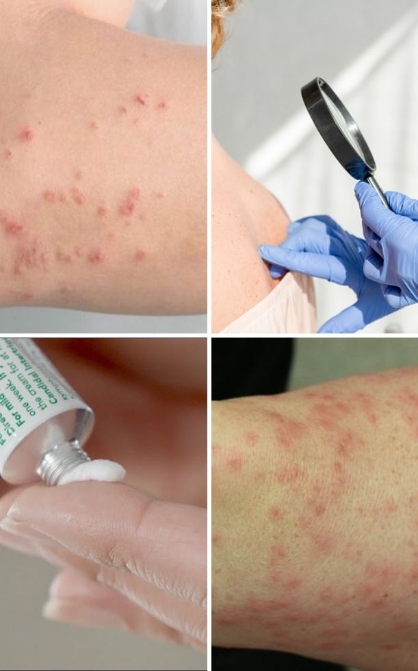 Da xuất hiện đốm đỏ: Nguyên nhân, dấu hiệu và cách xử lý