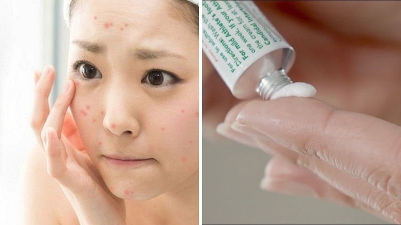 Cách xử lý khi da xuất hiện đốm đỏ