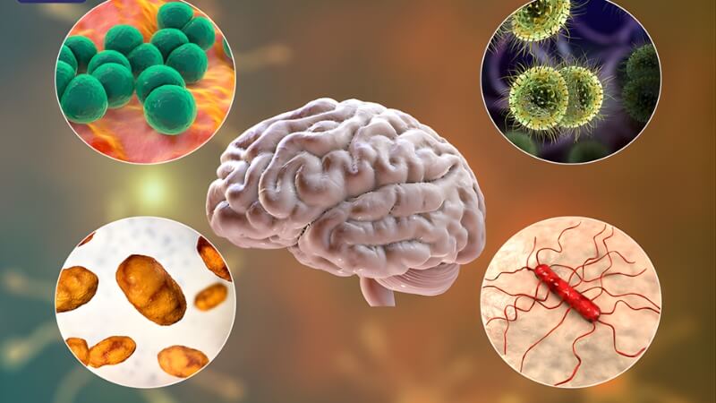 Cách phòng ngừa viêm màng não mô cầu Cách phòng ngừa viêm màng não mô cầu