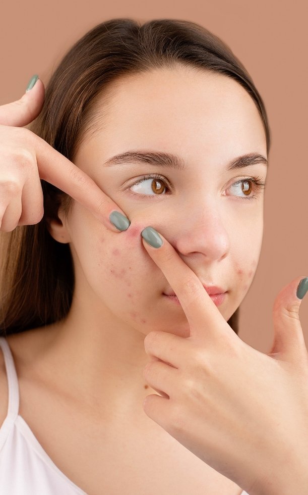 Sau khi nặn mụn nên làm gì? Cách chăm sóc da sau khi lấy nhân mụn