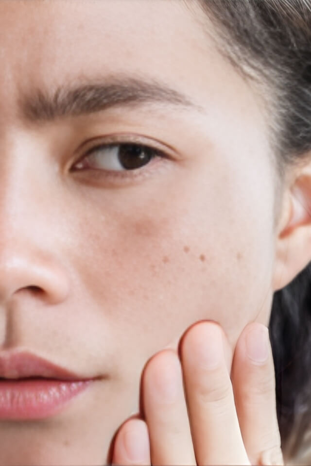 Xuất hiện đốm đen trên da mặt là gì? Nguyên nhân và cách điều trị hiệu quả