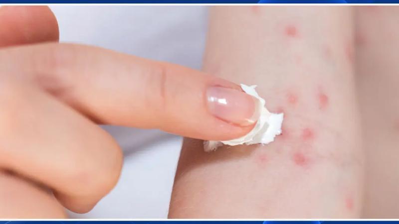 Sử dụng thuốc bôi da Sử dụng thuốc bôi da