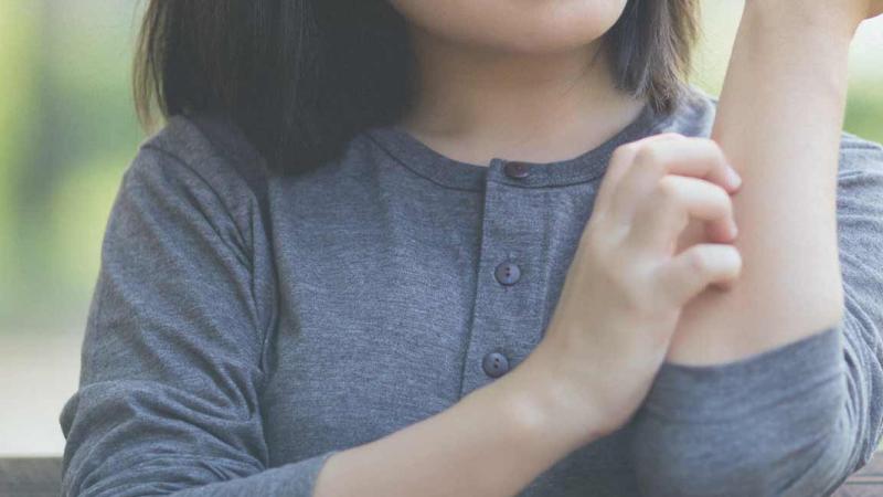 Dị ứng da thời tiết có tự hết không? Dị ứng da thời tiết có tự hết không?