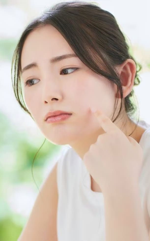 Bị khô da mặt phải làm sao? Các cách cấp ẩm và phục hồi nhanh