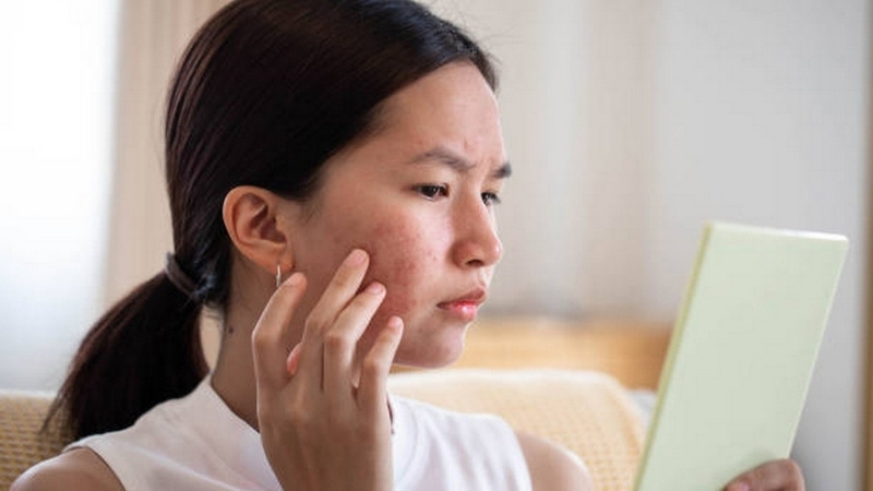 Cơ thể bị nổi mụn