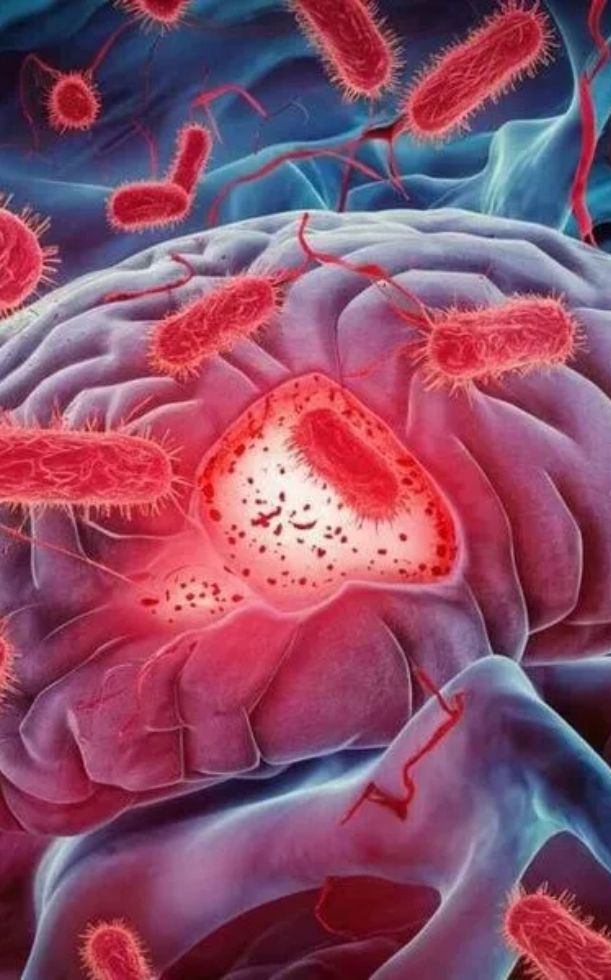 Viêm não mô cầu có lây không? Cơ chế lây truyền & Cách phòng