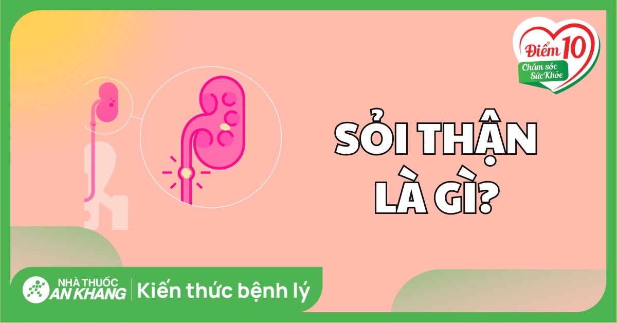 Sỏi thận: Nguyên nhân, dấu hiệu và cách điều trị