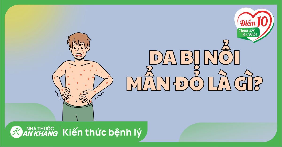 Da bị nổi mẩn đỏ: Nguyên nhân và cách điều trị