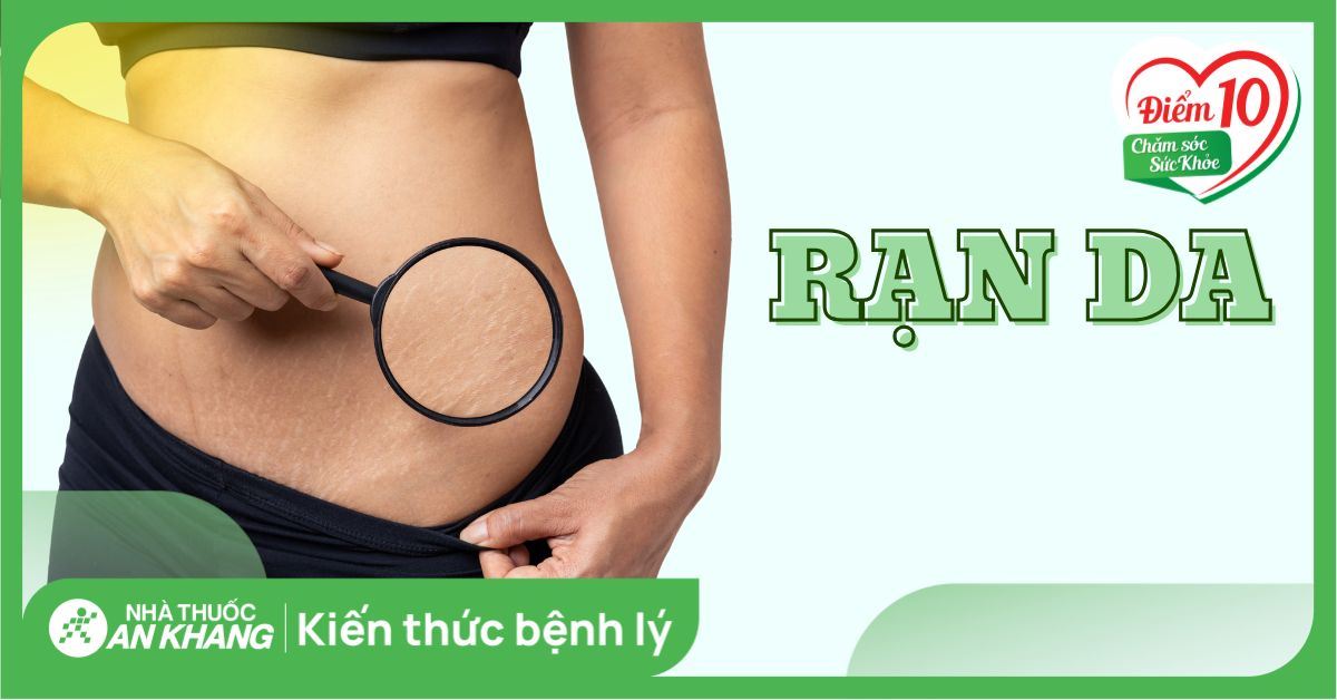 Rạn da: Nguyên nhân, dấu hiệu và cách điều trị hiệu quả