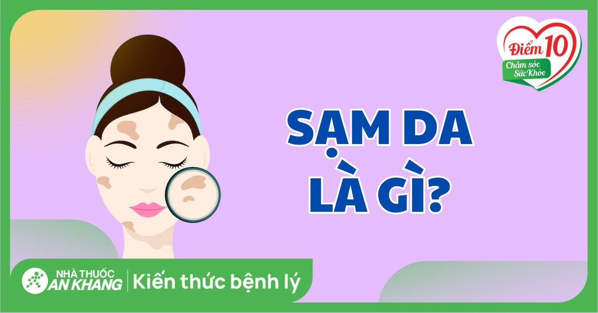 Sạm da là gì? Nguyên nhân, cách điều trị và phòng ngừa