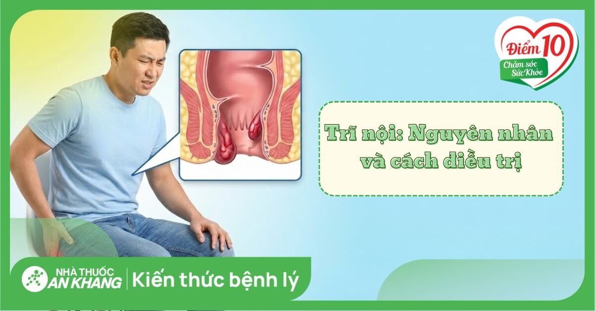 Trĩ nội: Nguyên nhân, triệu chứng và cách điều trị hiệu quả