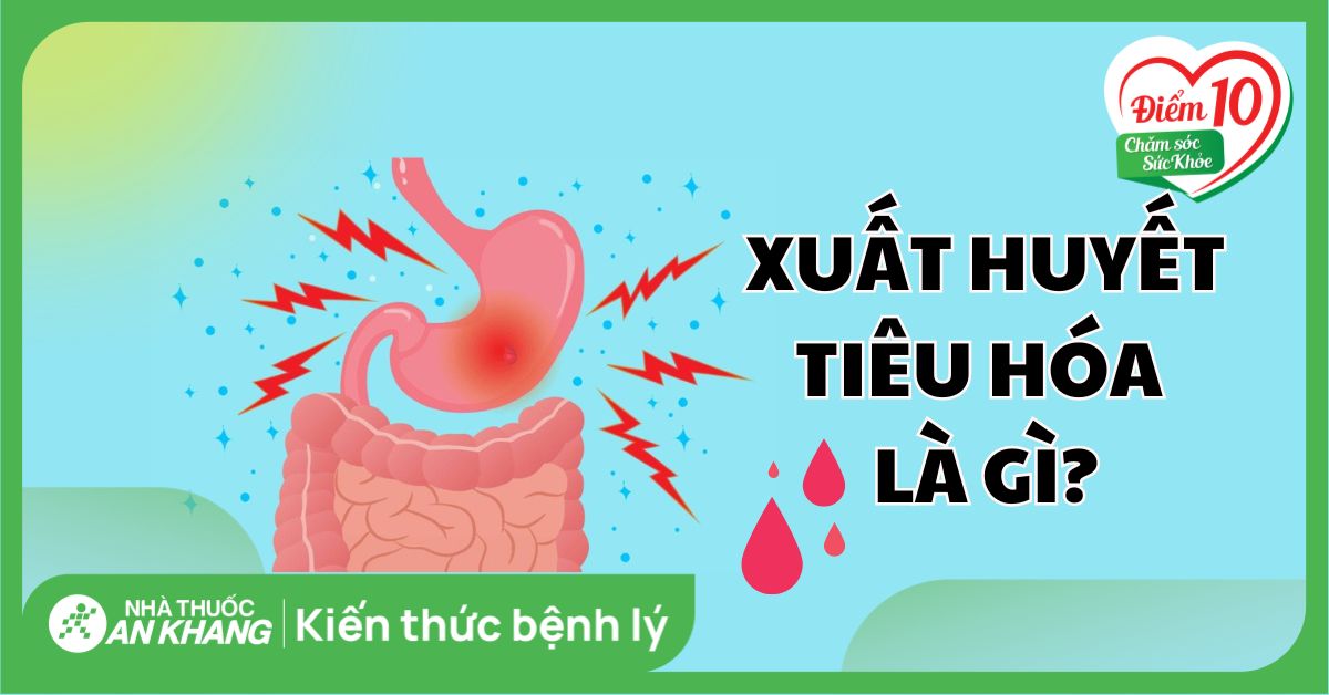 Xuất huyết tiêu hoá: Nguyên nhân, triệu chứng, cách điều trị