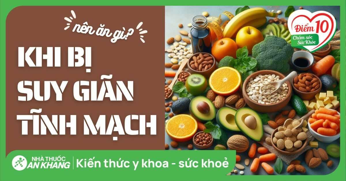 Bệnh suy giãn tĩnh mạch nên ăn gì và kiêng ăn gì?