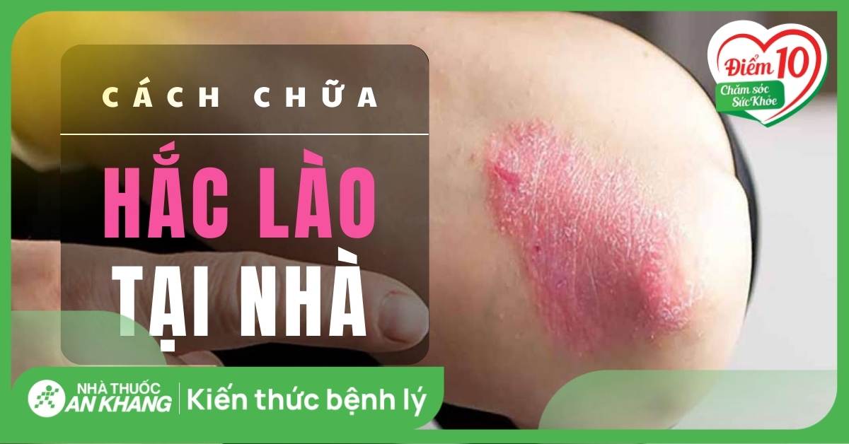 13 mẹo giúp chữa hắc lào hiệu quả, nhanh khỏi, đơn giản tại nhà