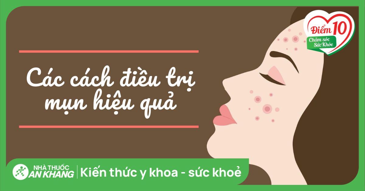 Các cách điều trị mụn hiệu quả bác sĩ khuyên bạn nên biết