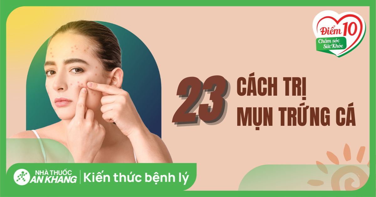 23 cách trị mụn trứng cá tại nhà an toàn, hiệu quả trong thời gian ngắn