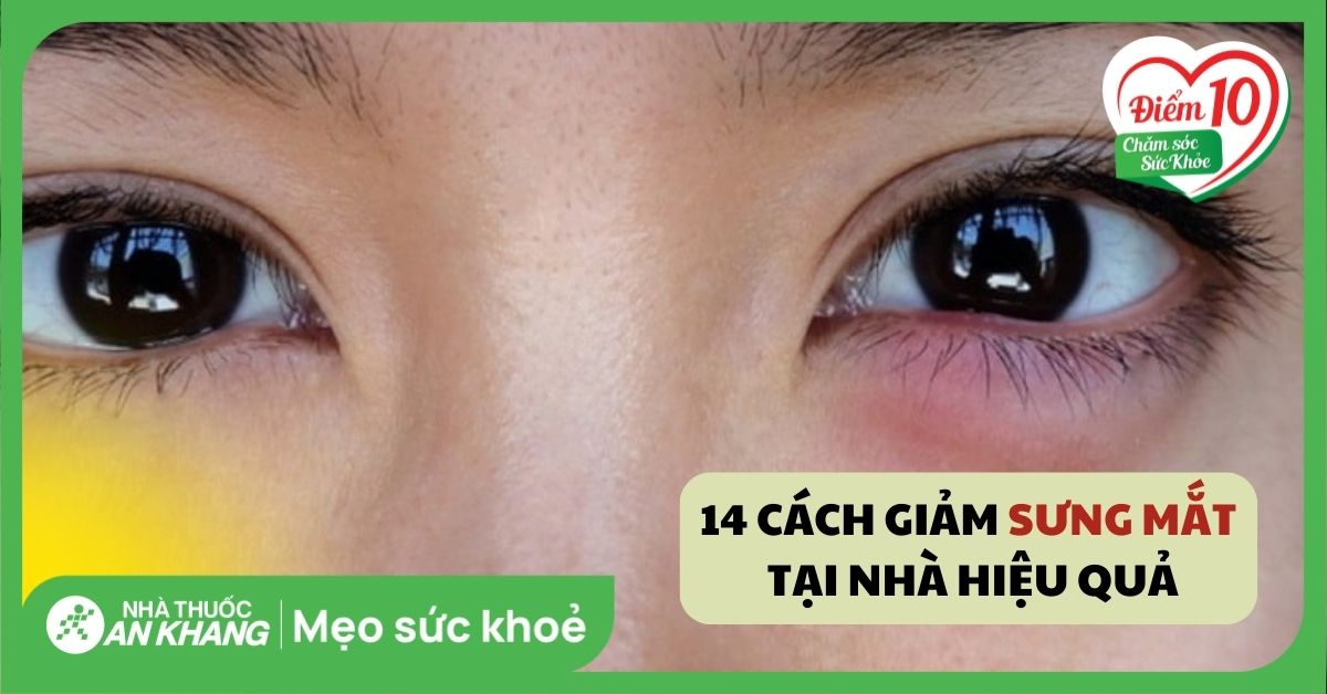 14 cách giảm sưng mắt tại nhà hiệu quả và các lưu ý khi thực hiện