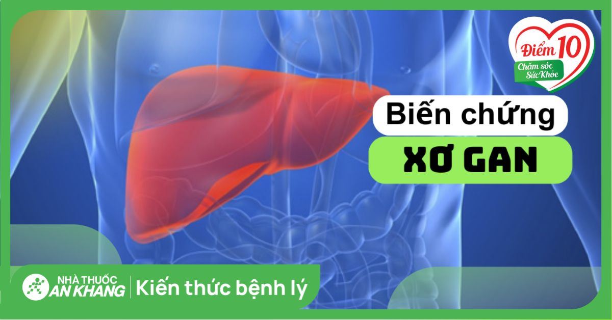 10 biến chứng xơ gan bạn không nên xem thường