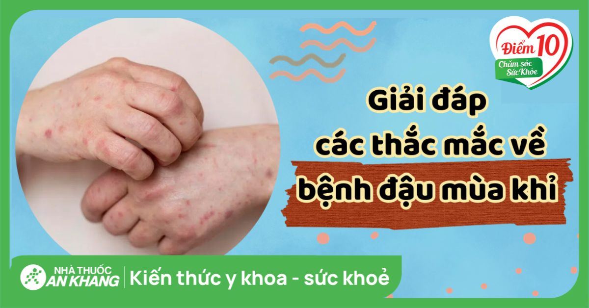 Giải đáp các thắc mắc về bệnh đậu mùa khỉ giúp hiểu rõ bệnh