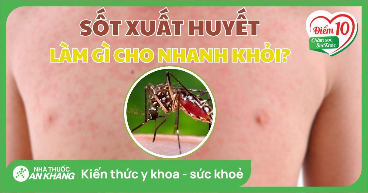 Sốt xuất huyết làm gì cho nhanh khỏi? Các lưu ý cần tránh