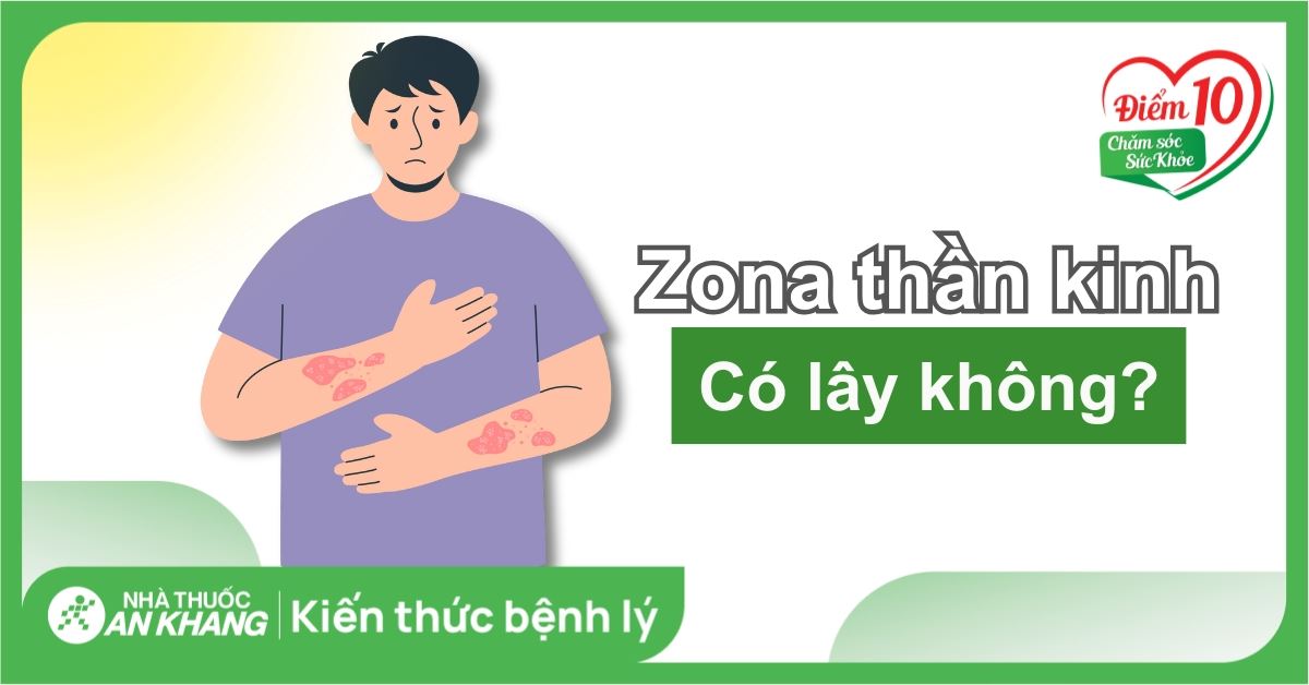 Zona thần kinh có lây không? Zona thần kinh lây qua đường nào?