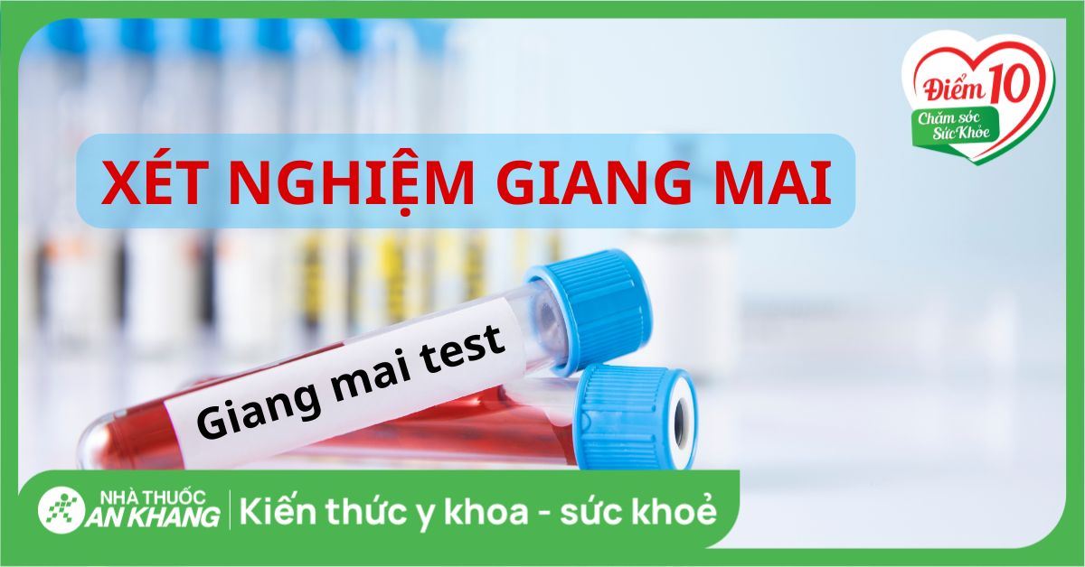 Xét nghiệm giang mai: Khi nào cần làm và bao lâu có kết quả