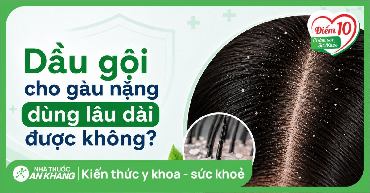 Dầu gội chuyên biệt cho gàu nặng và dai dẳng có dùng lâu dài được không?