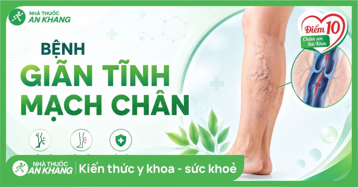 Bệnh giãn tĩnh mạch chân: Nguyên nhân, triệu chứng và giải pháp hỗ trợ