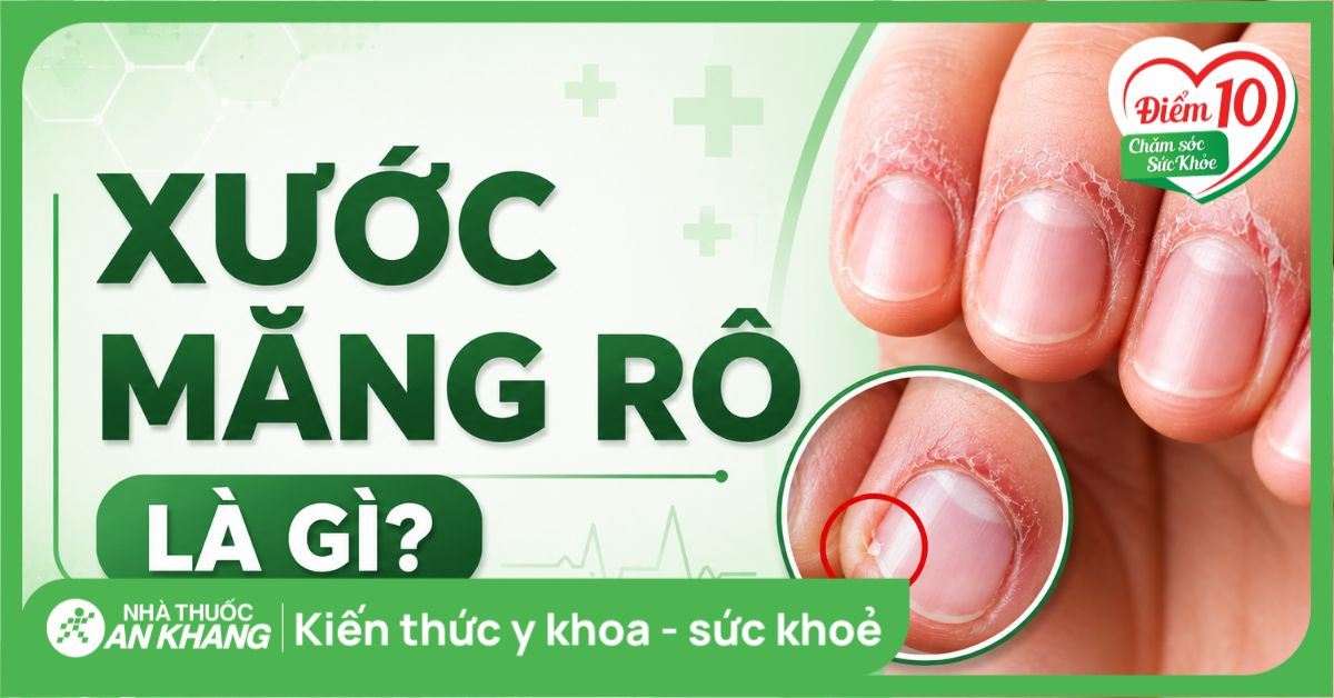Xước măng rô là gì? Nguyên nhân và cách xử lý an toàn tại nhà