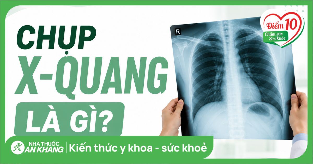 Chụp X-quang là gì? Quy trình, chi phí và các lưu ý quan trọng cần biết