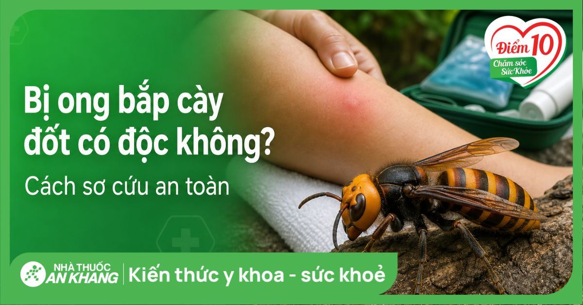 Bị ong bắp cày đốt có độc không? Cách sơ cứu an toàn