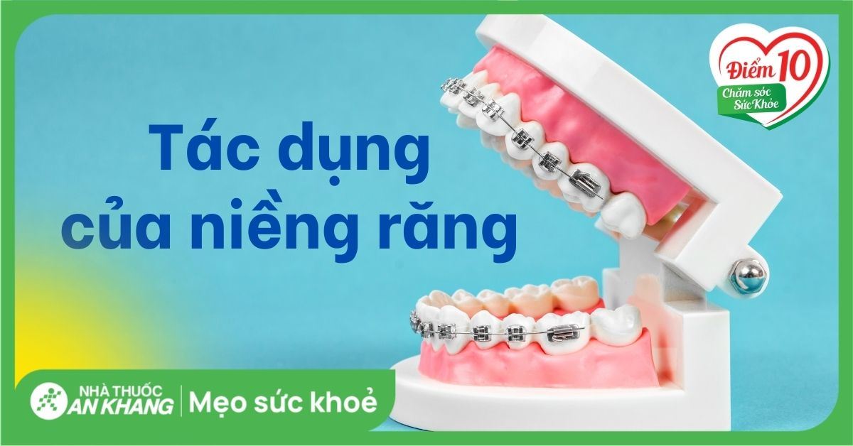 Niềng răng có tác dụng gì? Bí quyết cho nụ cười hoàn hảo