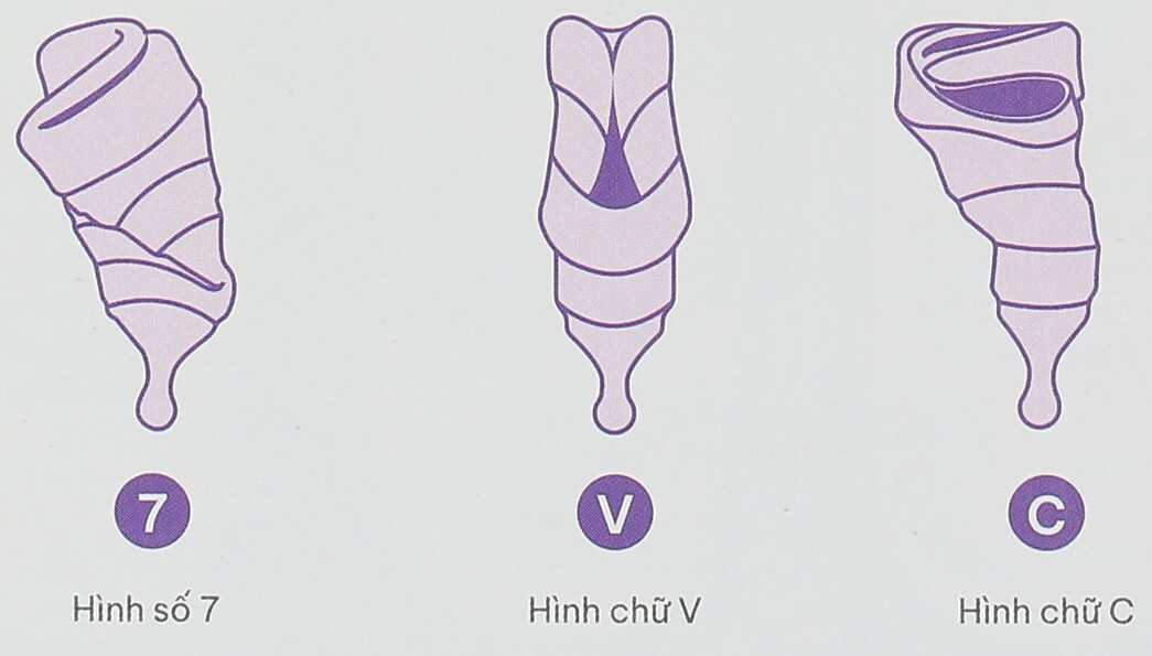 Cuộn cốc
