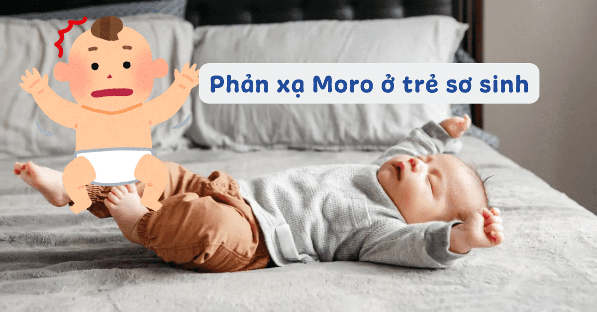 Phản xạ Moro: Trẻ sơ sinh giật mình co tay chân có sao không, khi nào thì hết?