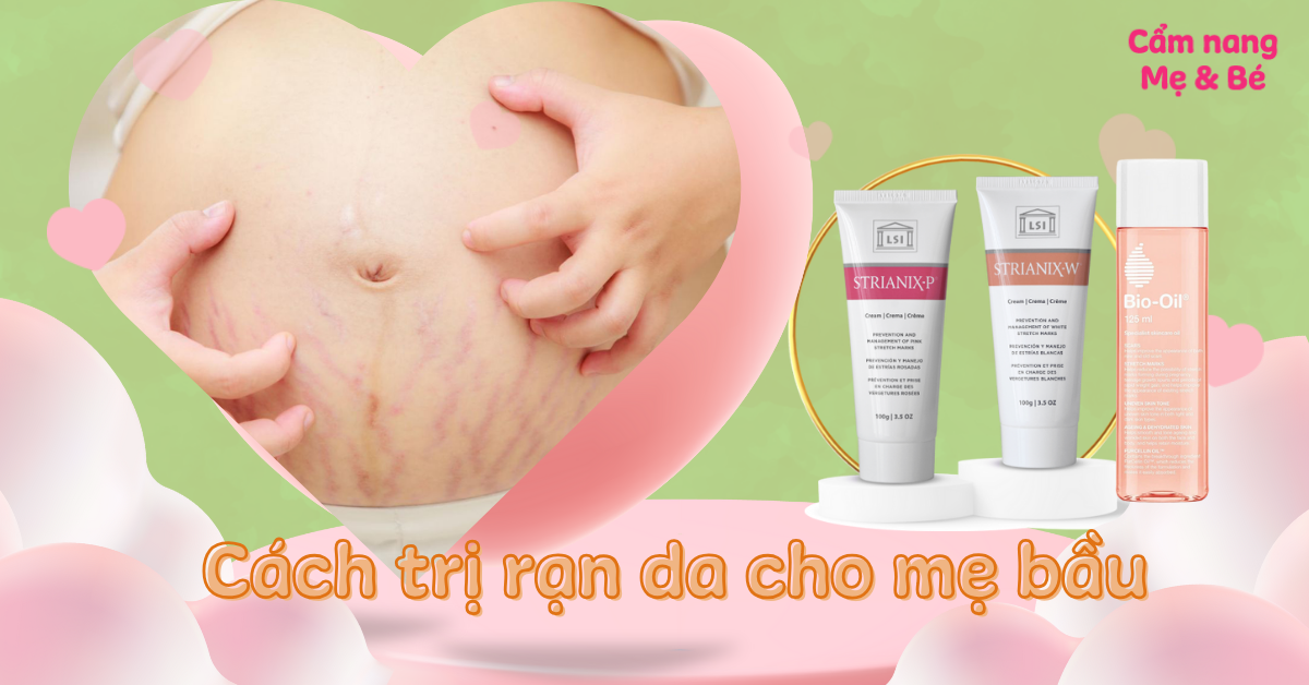 10 Cách trị rạn da cho mẹ bầu tại nhà hiệu quả nhanh chóng, an toàn