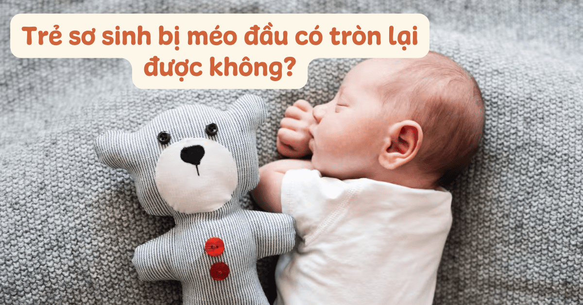 Trẻ bị méo đầu có tròn lại được không? Bác sĩ Nhi Khoa giải đáp và hướng dẫn cách phòng tránh