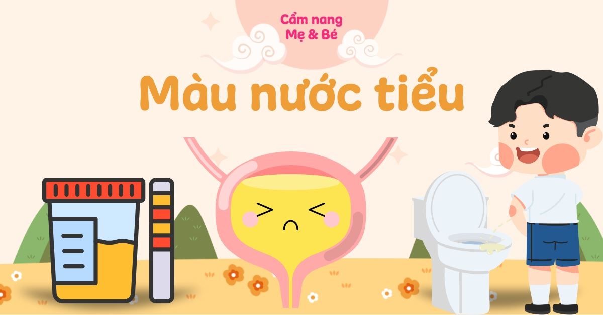 Màu nước tiểu thế nào là bình thường? Bảng tổng quan màu nước tiểu