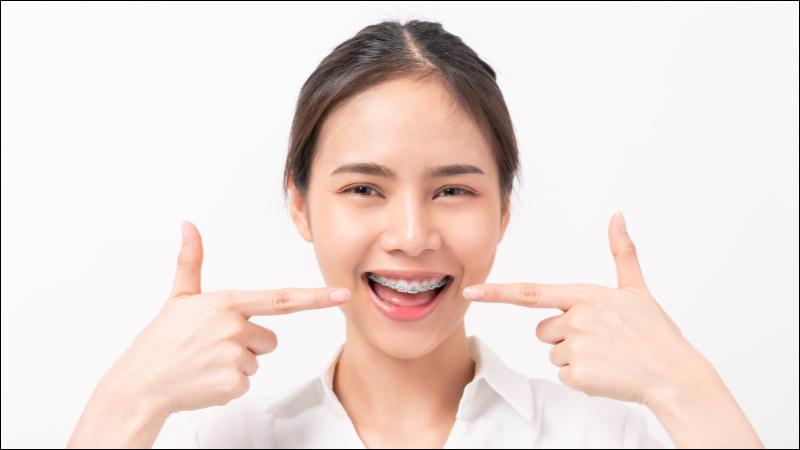 Cảm giác đau khi niềng răng sẽ biến mất trong vòng 7 - 10 ngày