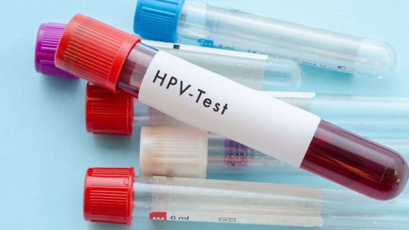 Xét nghiệm HPV được ưu tiên chỉ định thực hiện cho phụ nữ trên 30 tuổi và có nguy cơ cao