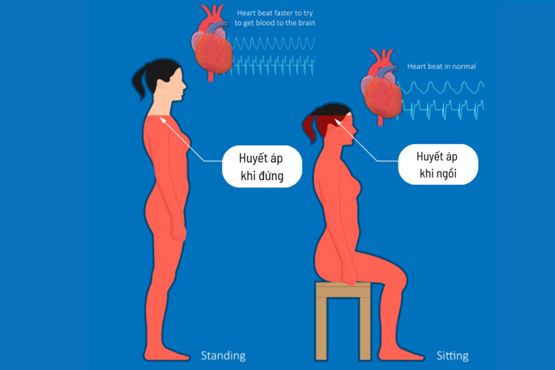 Yếu tố bên ngoài như tư thế ngồi, ăn uống, tâm lý tác động mạnh đến chỉ số huyết áp mỗi ngày Yếu tố bên ngoài như tư thế ngồi, ăn uống, tâm lý tác động mạnh đến chỉ số huyết áp mỗi ngày