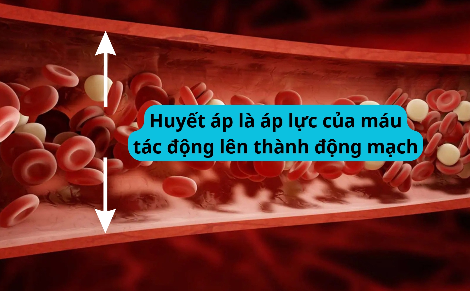 Huyết áp là áp lực của máu tác động lên thành động mạch