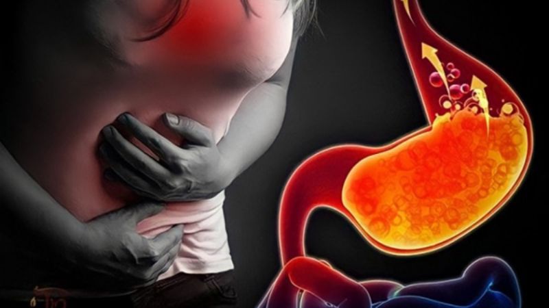 Tiêu thụ quá nhiều cây bồ công anh có thể dẫn tới ợ nóng Tiêu thụ quá nhiều cây bồ công anh có thể dẫn tới ợ nóng