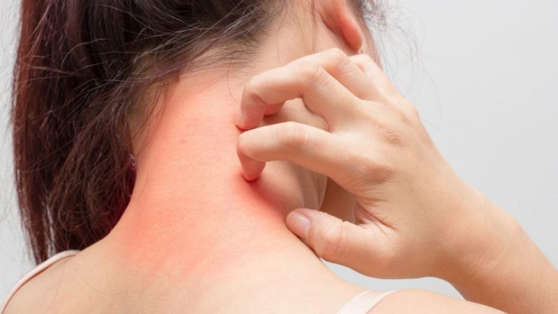 Vài hoạt chất trong thành phần của trái nhàu có thể dẫn tới tình trạng dị ứng Vài hoạt chất trong thành phần của trái nhàu có thể dẫn tới tình trạng dị ứng