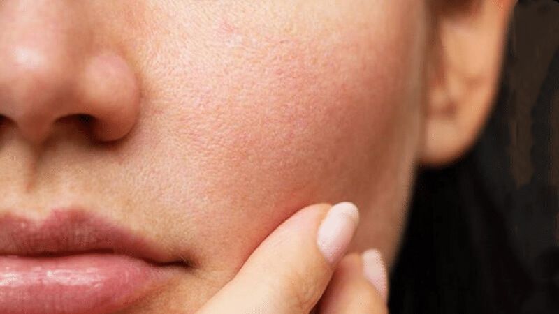 Chọn sản phẩm phù hợp với từng loại da