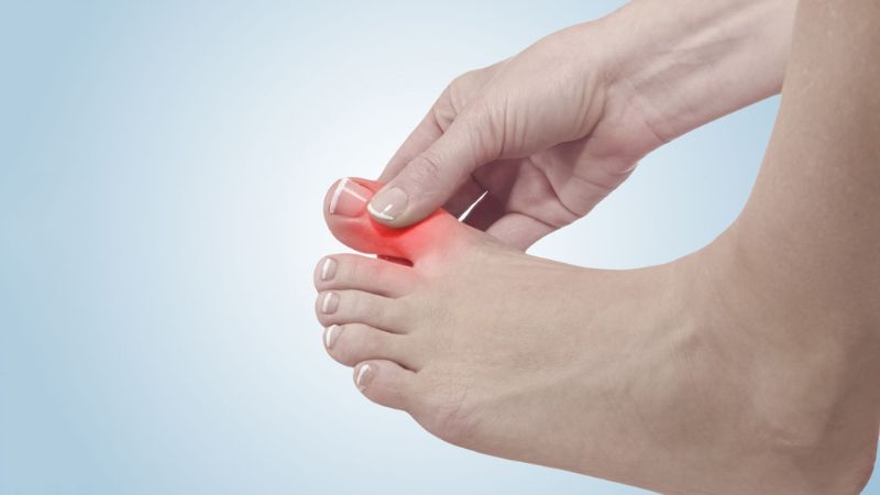 Gãy xương ngón nhân do tai nạn sẽ khiến người bệnh đau dữ dội ngay lập tức