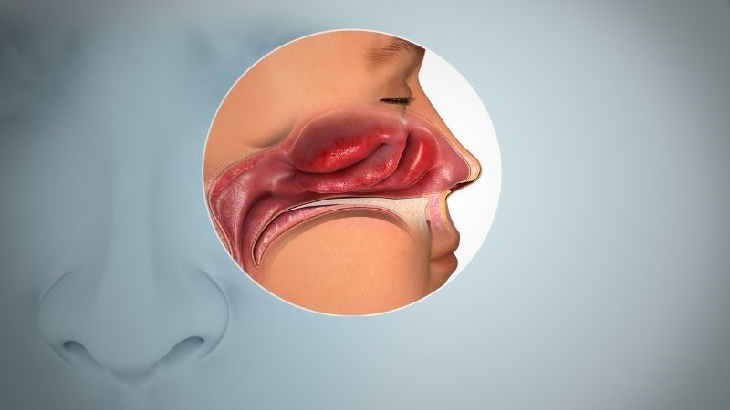Tiền sử viêm mũi dị ứng có thể làm tăng nguy cơ hen suyễn