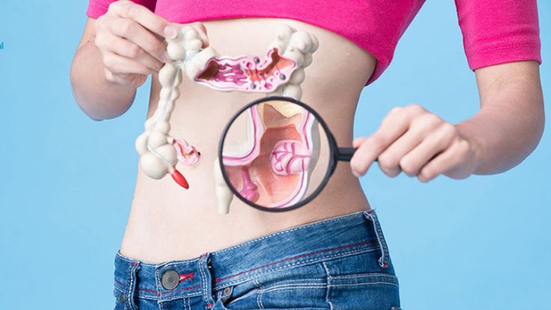Một số nhỏ bệnh nhân polyp đại tràng có thể chuyển ác tính thành ung thư Một số nhỏ bệnh nhân polyp đại tràng có thể chuyển ác tính thành ung thư