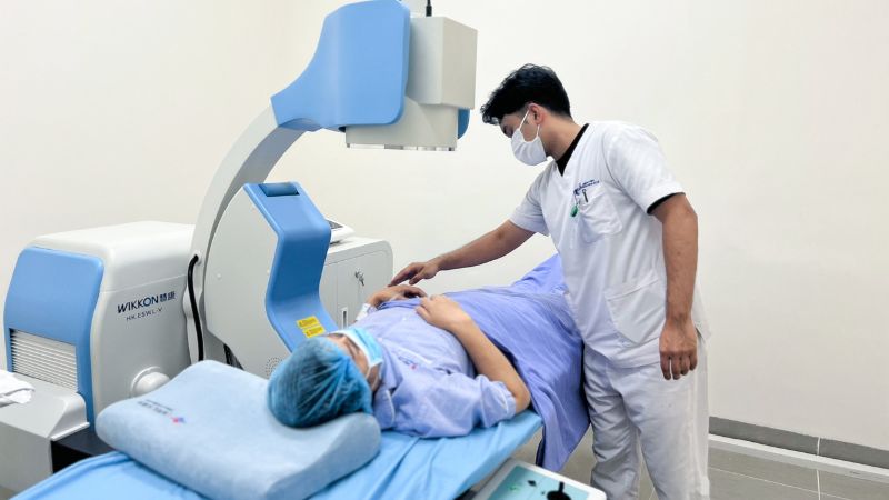Tán sỏi bằng sóng xung kích được áp dụng phổ biến hiện nay