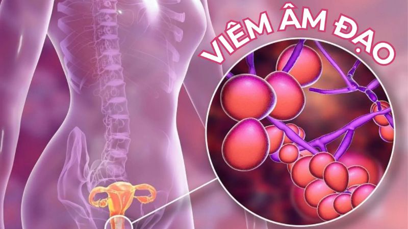 Tiền sử mắc STI nhiều lần cũng là yếu tố tăng nguy cơ của bênh lây truyền qua đường tình dục Tiền sử mắc STI nhiều lần cũng là yếu tố tăng nguy cơ của bênh lây truyền qua đường tình dục