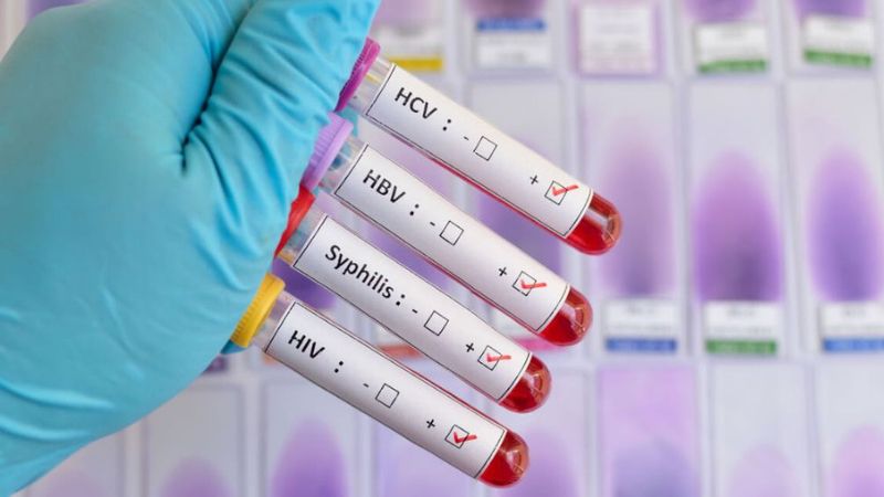 Bạn nên sàng lọc bệnh định kỳ cho cả bản thân và bạn tình để điều trị sớm Bạn nên sàng lọc bệnh định kỳ cho cả bản thân và bạn tình để điều trị sớm